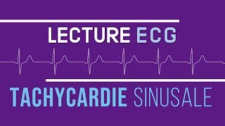 Interprétation ECG  Tachycardie Sinusale [upl. by Arannahs796]