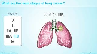 Ersticken am Lebensende Lungenkrebs COPD Lungenfibrose [upl. by Betteann]