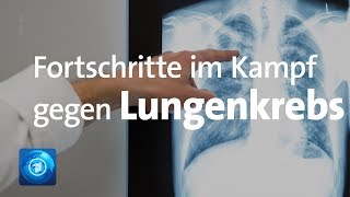 Lungenkrebs – Die unterschiedlichen Therapiemöglichkeiten [upl. by Ube471]