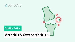 Arthritis amp Osteoarthritis  Part 1 Joint Structure [upl. by Eikcor]