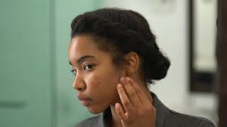 How to treat acne in skin of color [upl. by Fulviah937]