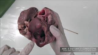 VIDEOCORSO ANATOMIA UMANA CUORE I [upl. by Klump]