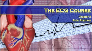 The ECG Course  Atrial Rhythms [upl. by Enatan69]