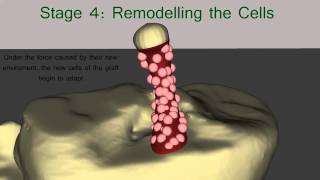 The Healing Process of the ACL Graft [upl. by Farwell760]