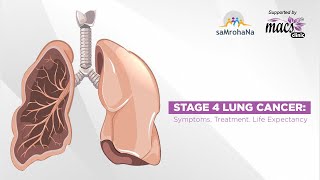 Lungenkrebs So sieht die moderne Therapie bei einem Bronchialkarzinom aus  Asklepios [upl. by Ole]