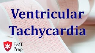 Ventricular Tachycardia ECG  EMTprepcom [upl. by Oppen]