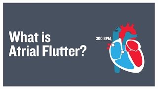 What is atrial flutter [upl. by Jacobo]