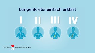 Fortschritte im Kampf gegen Lungenkrebs [upl. by Kalin]