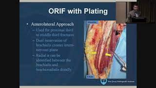 Humeral Shaft Fractures  John Callaghan MD [upl. by Girhiny]